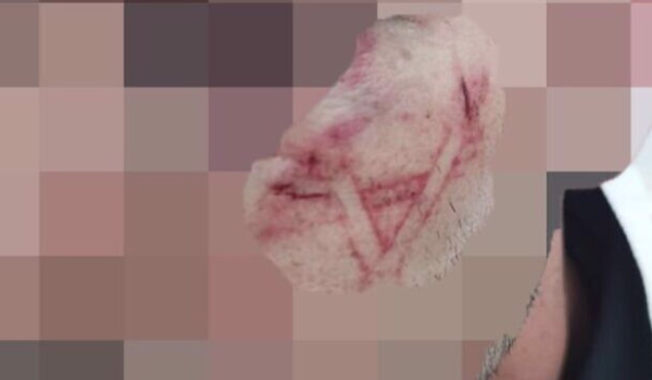 Brutale Arrestation en Israël : Marquage...